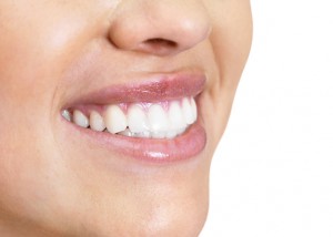 Bělení zubů pro dokonalý úsměv